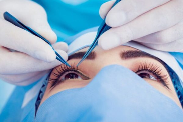 Lasik Eye Surgery