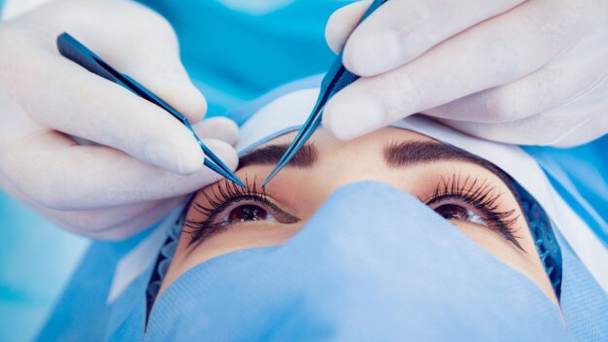 Lasik Eye Surgery